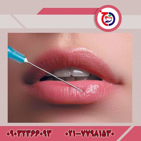 ژل صورت برای فرم‌دهی گونه و خط فک چگونه عمل می‌کند؟